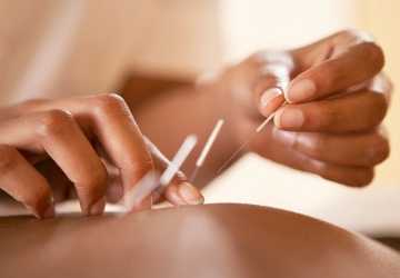 Who Should Consider Acupuncture for Pain Relief?